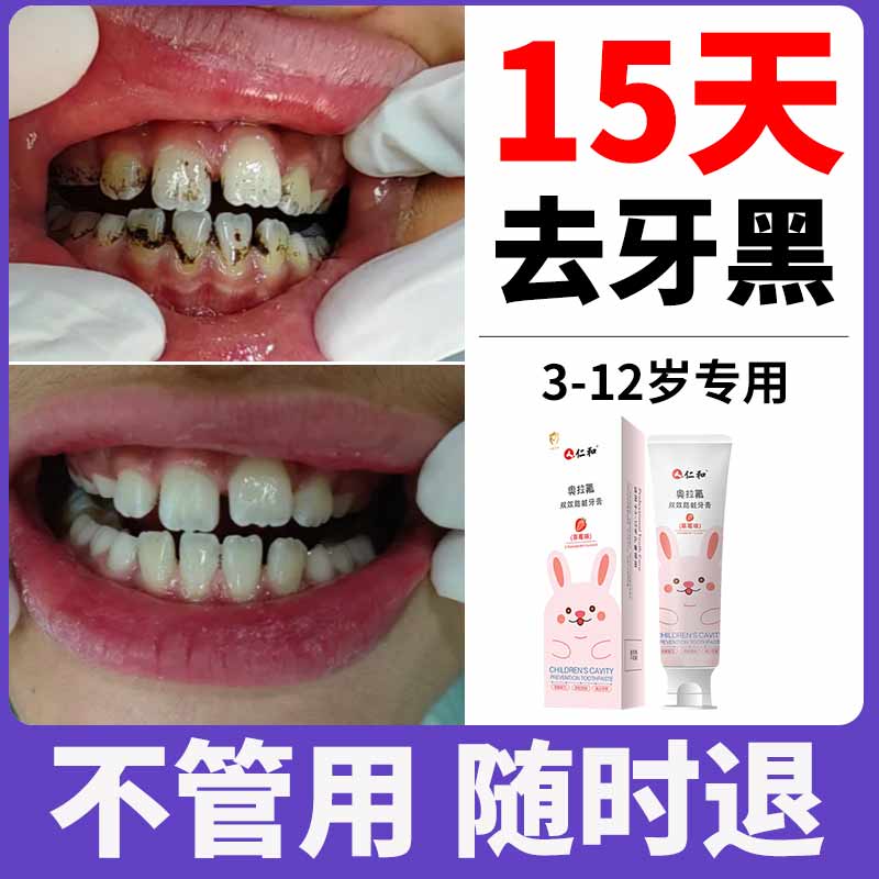 奥拉氟含氟儿童牙膏3一6一12岁换牙期牙黑牙黄非可吞咽防蛀牙正品
