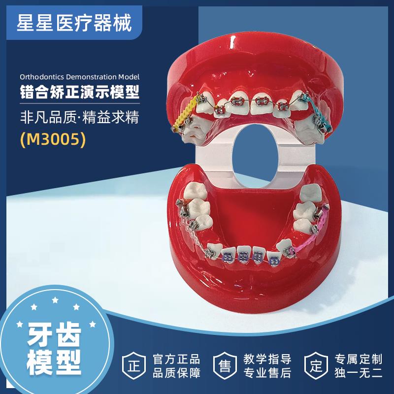 星星医疗牙科正畸错合矫正模型牙模口腔教学牙齿修复练习展示牙模