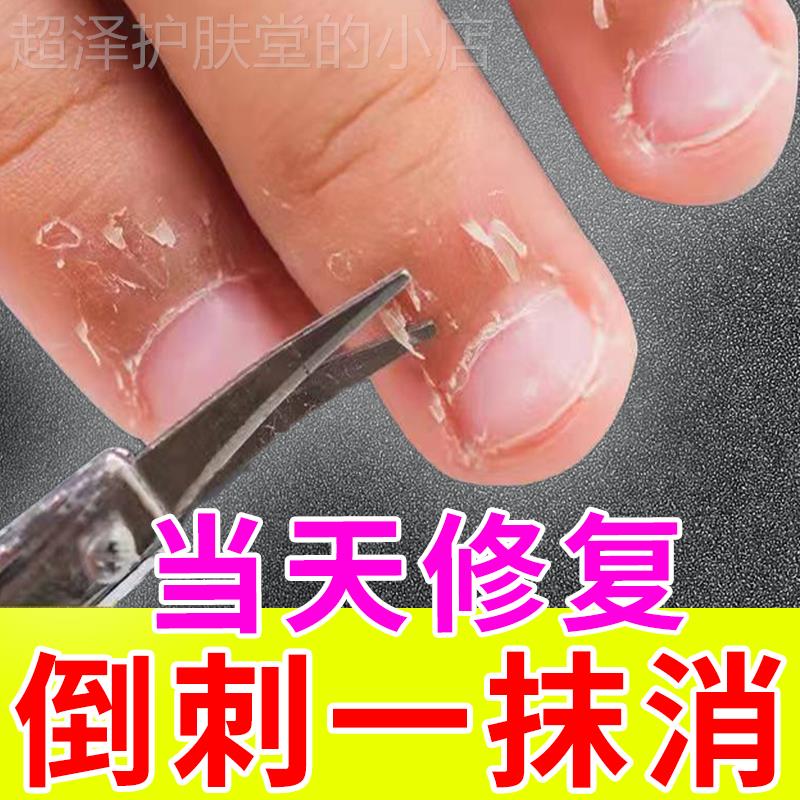 厂家手指倒刺修复液肉刺脱皮干裂软化剂专用受损再生甲营养油