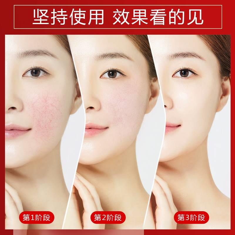面油去红血丝改屏敏感肌厚修复角质层脸部泛红受损善障增肤专用.