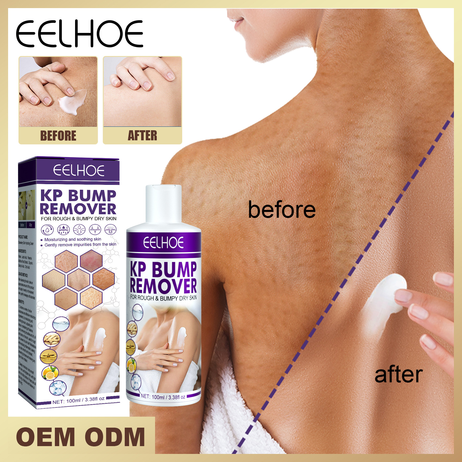 EELHOE 毛发角化病去除膏 去除角质污垢修护皮肤保持肌肤水润光滑
