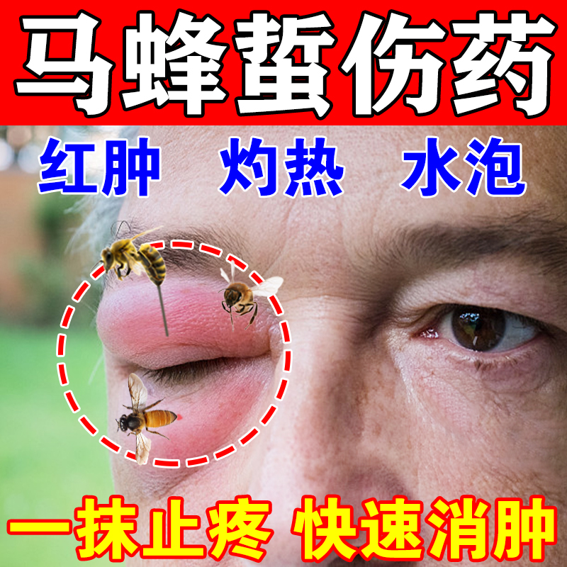 极速蜜蜂马蜂蛰伤药膏蜂蛰一喷灵养蜂专用工具蜂王叮咬消红肿止痛