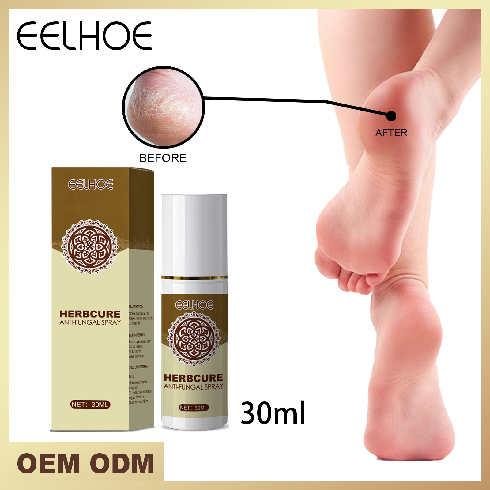 EELHOE 足部喷雾 滋润皮肤去角质防止瘙痒足部皮肤干裂止汗去脚臭