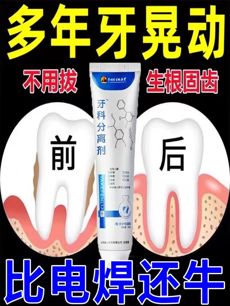 李时珍护牙小银管牙龈萎缩松动牙齿出血牙肉再生牙膏分离剂固齿