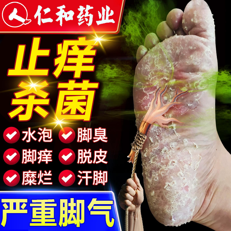 治疗脚气止痒脱皮杀菌烂脚丫趾缝痒糜烂去真菌感染水泡型专用药BF