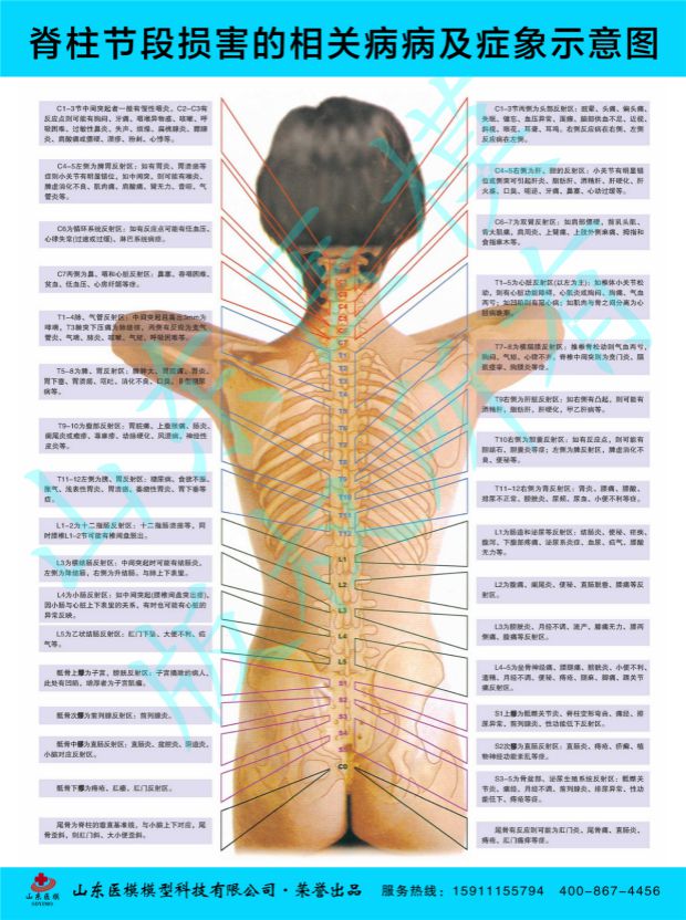 脊柱挂图脊柱疾病海报脊柱节段损害的相关疾病及症像示意图挂图